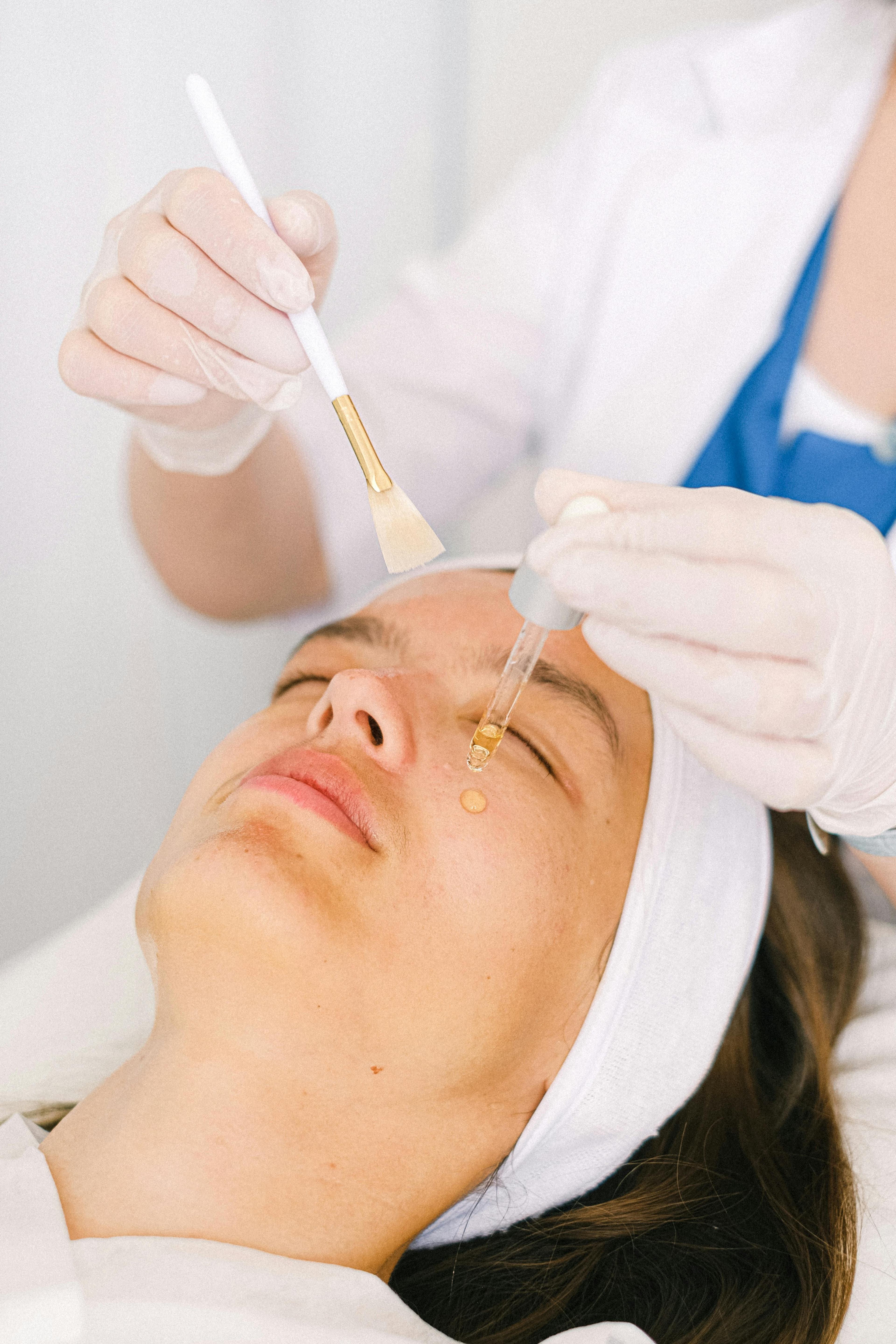Chemický peeling