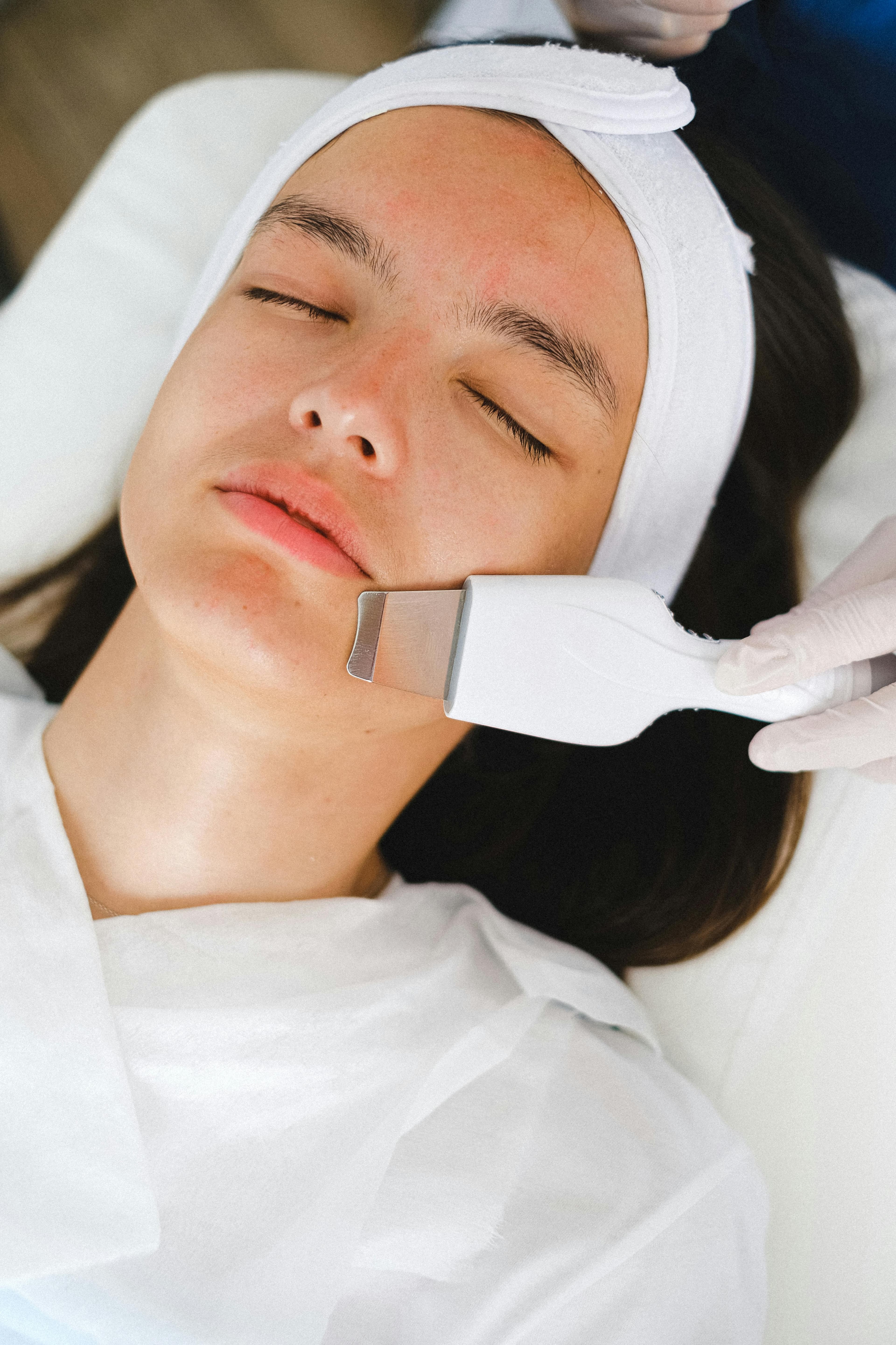 Ultrazvukový peeling